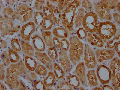 IHC image of CSB-RA188594A0HU diluted at 1:100 and staining in paraffin-embedded human kidney tissue performed on a Leica BondTM system. After dewaxing and hydration, antigen retrieval was mediated by high pressure in a citrate buffer (pH 6.0) . Section was blocked with 10% normal goat serum 30min at RT. Then primary antibody (1% BSA) was incubated at 4℃ overnight. The primary is detected by a Goat anti-rabbit IgG polymer labeled by HRP and visualized using 0.05% DAB.