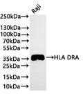 Western Blot
Positive WB detected in: Raji whole cell lysate(30µg) 
All lanes: HLA DRA antibody at 1:1000
Secondary
Goat polyclonal to rabbit IgG at 1/40000 dilution
Predicted band size: 29 kDa
Observed band size: 35 kDa
Exposure time：2min40s