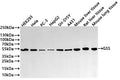 Western Blot
Positive WB detected in:  HEK293 whole cell lysate(30µg) , Hela whole cell lysate(30µg) , PC-3 whole cell lysate(30µg) , HepG2 whole cell lysate(30µg) , SH-SY5Y whole cell lysate(30µg) , A431 whole cell lysate(30µg) , Mouse liver tissue lysate(30µg) , Rat liver tissue lysate(30µg) , Mouse lung tissue lysate(30µg) 
All lanes: GSS  antibody at 1:1000
Secondary
Goat polyclonal to rabbit IgG at 1/40000 dilution
Predicted band size: 52 kDa
Observed band size: 52 kDa
Exposure time：2min
