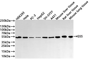 Western Blot
Positive WB detected in:  HEK293 whole cell lysate(30µg) , Hela whole cell lysate(30µg) , PC-3 whole cell lysate(30µg) , HepG2 whole cell lysate(30µg) , SH-SY5Y whole cell lysate(30µg) , A431 whole cell lysate(30µg) , Mouse liver tissue lysate(30µg) , Rat liver tissue lysate(30µg) , Mouse lung tissue lysate(30µg) 
All lanes: GSS  antibody at 1:1000
Secondary
Goat polyclonal to rabbit IgG at 1/40000 dilution
Predicted band size: 52 kDa
Observed band size: 52 kDa
Exposure time：2min