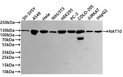 Western Blot
Positive WB detected in: SH-SY5Y whole cell lysate(20µg) , A549 whole cell lysate(20µg) , Hela whole cell lysate(20µg) , NIH/3T3 whole cell lysate(20µg) , HEK293 whole cell lysate(20µg) , PC-3 whole cell lysate(20µg) , COLO205 whole cell lysate(20µg) ,Jurkat whole cell lysate(20µg) ,HepG2 whole cell lysate(20µg) 
All lanes: NAT10 antibody at 1:1000
Secondary
Goat polyclonal to rabbit IgG at 1/40000 dilution
Predicted band size: 116 kDa
Observed band size: 130 kDa
Exposure time：20s