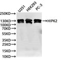 Western Blot
Positive WB detected in: U251 whole cell lysate(30µg), HEK293 whole cell lysate(30µg), PC-3 whole cell lysate(30µg)
All lanes: HIPK2 binding protein 1 antibody at 1:1000
Secondary
Goat polyclonal to rabbit IgG at 1/40000 dilution
Predicted band size: 130 kDa
Observed band size: 130 kDa
Exposure time：2min