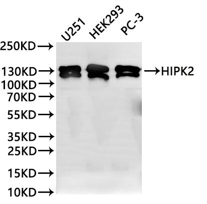Western Blot
Positive WB detected in: U251 whole cell lysate(30µg), HEK293 whole cell lysate(30µg), PC-3 whole cell lysate(30µg)
All lanes: HIPK2 binding protein 1 antibody at 1:1000
Secondary
Goat polyclonal to rabbit IgG at 1/40000 dilution
Predicted band size: 130 kDa
Observed band size: 130 kDa
Exposure time：2min