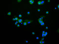 Immunofluorescence staining of HepG2 cell with CSB-RA189952A0HU at 1:50 , counter-stained with DAPI. The cells were fixed in 4% formaldehyde, permeabilized using 0.2% Triton X-100 and blocked in 10% normal Goat Serum. The cells were then incubated with the antibody overnight at 4°C. The secondary antibody was Alexa Fluor 488-congugated AffiniPure Goat Anti-Rabbit IgG(H+L).