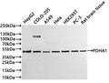Western Blot
Positive WB detected in: HepG2 whole cell lysate(20µg) ,COLO-205 whole cell lysate(20µg) , A549 whole cell lysate(20µg) , Hela whole cell lysate(20µg) ,HEK293T whole cell lysate(20µg) ,PC-3 whole cell lysate(20µg) ,Rat brain tissue lysate(20µg) 
All lanes: PDHA1 antibody at 1:1000
Secondary
Goat polyclonal to rabbit IgG at 1/40000 dilution
Predicted band size: 43 kDa
Observed band size: 45 kDa
Exposure time：1min