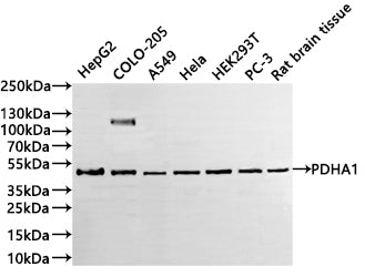 Western Blot
Positive WB detected in: HepG2 whole cell lysate(20µg) ,COLO-205 whole cell lysate(20µg) , A549 whole cell lysate(20µg) , Hela whole cell lysate(20µg) ,HEK293T whole cell lysate(20µg) ,PC-3 whole cell lysate(20µg) ,Rat brain tissue lysate(20µg) 
All lanes: PDHA1 antibody at 1:1000
Secondary
Goat polyclonal to rabbit IgG at 1/40000 dilution
Predicted band size: 43 kDa
Observed band size: 45 kDa
Exposure time：1min