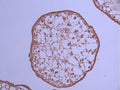 IHC image of CSB-RA190124A0HU diluted at 1:100 and staining in paraffin-embedded human placenta tissue performed on a Leica BondTM system. After dewaxing and hydration, antigen retrieval was mediated by high pressure in a citrate buffer (pH 6.0) . Section was blocked with 10% normal goat serum 30min at RT. Then primary antibody (1% BSA) was incubated at 4°C overnight. The primary is detected by a Goat anti-rabbit polymer IgG labeled by HRP and visualized using 0.05% DAB.