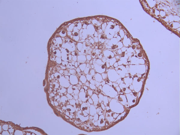 IHC image of CSB-RA190124A0HU diluted at 1:100 and staining in paraffin-embedded human placenta tissue performed on a Leica BondTM system. After dewaxing and hydration, antigen retrieval was mediated by high pressure in a citrate buffer (pH 6.0) . Section was blocked with 10% normal goat serum 30min at RT. Then primary antibody (1% BSA) was incubated at 4°C overnight. The primary is detected by a Goat anti-rabbit polymer IgG labeled by HRP and visualized using 0.05% DAB.