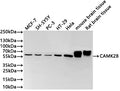 Western Blot
Positive WB detected in: MCF-7 whole cell lysate(30µg) , SH-SY5Y whole cell lysate(30µg) , PC-3 whole cell lysate(30µg) , HT-29 whole cell lysate(30µg) , Hela whole cell lysate(30µg) , Mouse brain tissue lysate(30µg) , Rat brain tissue lysate(30µg) 
All lanes: CAMK2B antibody at 1:1000
Secondary
Goat polyclonal to rabbit IgG at 1/40000 dilution
Predicted band size: 73 kDa
Observed band size: 55 kDa
Exposure time：2min