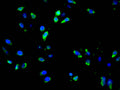 Immunofluorescence staining of Hela cell with CSB-RA191307A0HU at 1:50, counter-stained with DAPI. The cells were fixed in 4% formaldehyde and blocked in 10% normal Goat Serum. The cells were then incubated with the antibody overnight at 4°C. The secondary antibody was Alexa Fluor 488-congugated AffiniPure Goat Anti-Rabbit IgG(H+L) .