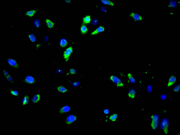 Immunofluorescence staining of Hela cell with CSB-RA191307A0HU at 1:50, counter-stained with DAPI. The cells were fixed in 4% formaldehyde and blocked in 10% normal Goat Serum. The cells were then incubated with the antibody overnight at 4°C. The secondary antibody was Alexa Fluor 488-congugated AffiniPure Goat Anti-Rabbit IgG(H+L) .