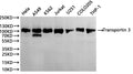 Western Blot
Positive WB detected in: hela whole cell lysate(30µg), A549 whole cell lysate(30µg), K562 whole cell lysate(30µg), Jurkat whole cell lysate(30µg), U251 whole cell lysate(30µg), COLO205 whole cell lysate(30µg), THP-1 whole cell lysate(30µg)
All lanes:Transportin 3antibody at 1:1000
Secondary
Goat polyclonal to rabbit IgG at 1/40000 dilution
Predicted band size: 100 kDa
Observed band size: 104 kDa
Exposure time：1min