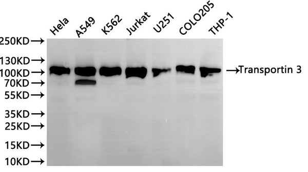 Western Blot
Positive WB detected in: hela whole cell lysate(30µg), A549 whole cell lysate(30µg), K562 whole cell lysate(30µg), Jurkat whole cell lysate(30µg), U251 whole cell lysate(30µg), COLO205 whole cell lysate(30µg), THP-1 whole cell lysate(30µg)
All lanes:Transportin 3antibody at 1:1000
Secondary
Goat polyclonal to rabbit IgG at 1/40000 dilution
Predicted band size: 100 kDa
Observed band size: 104 kDa
Exposure time：1min