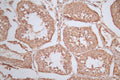 IHC image of CSB-RA191819A0HU diluted at 1:100 and staining in paraffin-embedded human testis tissue performed on a Leica BondTM system. After dewaxing and hydration, antigen retrieval was mediated by high pressure in a citrate buffer (pH 6.0) . Section was blocked with 10% normal goat serum 30min at RT. Then primary antibody (1% BSA) was incubated at 4°C overnight. The primary is detected by a Goat anti-rabbit polymer IgG labeled by HRP and visualized using 0.78% DAB.