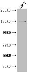 Western Blot
Positive WB detected in: K562 whole cell lysate
All lanes: HAUSP antibody at 1:1000
Secondary
Goat polyclonal to rabbit IgG at 1/50000 dilution
Predicted band size: 129, 127 kDa
Observed band size: 140 kDa