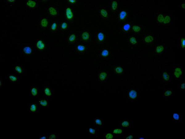 Immunofluorescence staining of Hela cell with CSB-RA192658A0HU at 1:50, counter-stained with DAPI. The cells were fixed in 4% formaldehyde, permeabilized using 0.2% Triton X-100 and blocked in 10% normal Goat Serum. The cells were then incubated with the antibody overnight at 4°C. The secondary antibody was Alexa Fluor 488-congugated AffiniPure Goat Anti-Rabbit IgG(H+L) .