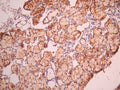 IHC image of CSB-RA192672A0HU diluted at 1:100 and staining in paraffin-embedded human salivary gland tissue performed on a Leica BondTM system. After dewaxing and hydration, antigen retrieval was mediated by high pressure in a citrate buffer (pH 6.0). Section was blocked with 10% normal goat serum 30min at RT. Then primary antibody (1% BSA) was incubated at 4°C overnight. The primary is detected by a Goat anti-rabbit polymer IgG labeled by HRP and visualized using 0.05% DAB.