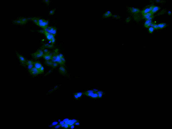 Immunofluorescence staining of SH-SY5Y cell with CSB-RA193105A0HU at 1:50, counter-stained with DAPI. The cells were fixed in 4% formaldehyde, permeabilized using 0.2% Triton X-100 and blocked in 10% normal Goat Serum. The cells were then incubated with the antibody overnight at 4°C. The secondary antibody was Alexa Fluor 488-congugated AffiniPure Goat Anti-Rabbit IgG(H+L) .
