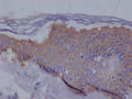 IHC image of CSB-RA194531A0HU diluted at 1:100 and staining in paraffin-embedded human skin tissue performed on a Leica BondTM system. After dewaxing and hydration, antigen retrieval was mediated by high pressure in a citrate buffer (pH 6.0) . Section was blocked with 10% normal goat serum 30min at RT. Then primary antibody (1% BSA) was incubated at 4°C overnight. The primary is detected by a Goat anti-rabbit polymer IgG labeled by HRP and visualized using 0.05% DAB.