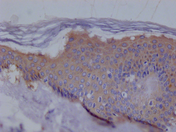 IHC image of CSB-RA194531A0HU diluted at 1:100 and staining in paraffin-embedded human skin tissue performed on a Leica BondTM system. After dewaxing and hydration, antigen retrieval was mediated by high pressure in a citrate buffer (pH 6.0) . Section was blocked with 10% normal goat serum 30min at RT. Then primary antibody (1% BSA) was incubated at 4°C overnight. The primary is detected by a Goat anti-rabbit polymer IgG labeled by HRP and visualized using 0.05% DAB.