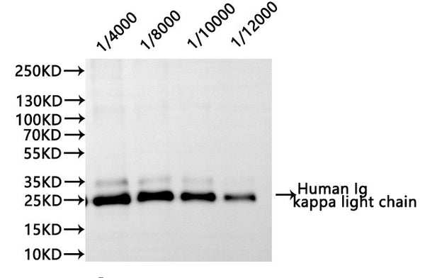 Western Blot, 
Positive WB detected in:Human Serum
All lanes: Human Ig kappa light chain antibody at 1:1000
Secondary
Goat polyclonal to rabbit IgG at 1/40000 dilution
Predicted band size: 12 kDa
Observed band size: 25 kDa
Exposure time：10s