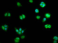 Immunofluorescence staining of MCF-7 cell with CSB-RA194900A0HU at 1:50, counter-stained with DAPI. The cells were fixed in 4% formaldehyde, permeabilized using 0.2% Triton X-100 and blocked in 10% normal Goat Serum. The cells were then incubated with the antibody overnight at 4°C. The secondary antibody was Alexa Fluor 488-congugated AffiniPure Goat Anti-Rabbit IgG(H+L) .