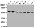 KLF4 Antibody – Figure 1 of 5