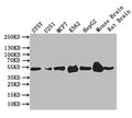 Western Blot
Positive WB detected in: SY5Y whole cell lysate,U251 whole cell lysate,MCF7 whole cell lysate,K562 whole cell lysate,Mouse Brain tissue lysate,Mouse Brain tissue lysate
All lanes: EGR2 antibody at 1:1000
Secondary
Goat polyclonal to rabbit IgG at 1/50000 dilution
Predicted band size: 50 kDa
Observed band size: 50 kDa