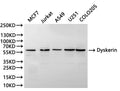 Western Blot
Positive WB detected in: MCF7 whole cell lysate(30µg), Jurkat whole cell lysate(30µg), A549 whole cell lysate(30µg), U251 whole cell lysate(30µg), COLO205 whole cell lysate(30µg), 
All lanes: Dyskerin antibody at 1:1000
Secondary
Goat polyclonal to rabbit IgG at 1/40000 dilution
Predicted band size: 58 kDa
Observed band size: 58 kDa
Exposure time: 30S