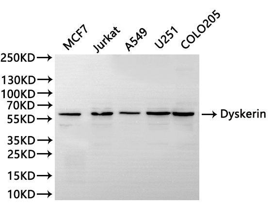 Western Blot
Positive WB detected in: MCF7 whole cell lysate(30µg), Jurkat whole cell lysate(30µg), A549 whole cell lysate(30µg), U251 whole cell lysate(30µg), COLO205 whole cell lysate(30µg), 
All lanes: Dyskerin antibody at 1:1000
Secondary
Goat polyclonal to rabbit IgG at 1/40000 dilution
Predicted band size: 58 kDa
Observed band size: 58 kDa
Exposure time: 30S