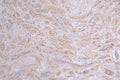 IHC image of CSB-RA197122A0HU diluted at 1:50 and staining in paraffin-embedded human kidney tissue performed on a Leica BondTM system. After dewaxing and hydration, antigen retrieval was mediated by high pressure in a citrate buffer (pH 6.0) . Section was blocked with 10% normal goat serum 30min at RT. Then primary antibody (1% BSA) was incubated at 4°C overnight. The primary is detected by a Goat anti-rabbit polymer IgG labeled by HRP and visualized using 0.47% DAB.