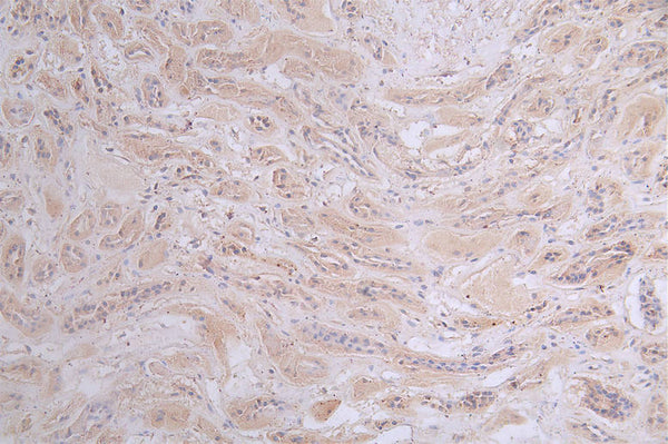 IHC image of CSB-RA197122A0HU diluted at 1:50 and staining in paraffin-embedded human kidney tissue performed on a Leica BondTM system. After dewaxing and hydration, antigen retrieval was mediated by high pressure in a citrate buffer (pH 6.0) . Section was blocked with 10% normal goat serum 30min at RT. Then primary antibody (1% BSA) was incubated at 4°C overnight. The primary is detected by a Goat anti-rabbit polymer IgG labeled by HRP and visualized using 0.47% DAB.
