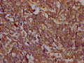 PTK2 Antibody – Figure 1 of 1