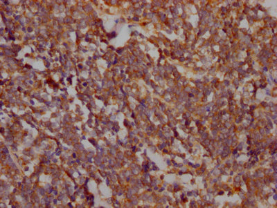 PTK2 Antibody – Figure 1 of 1