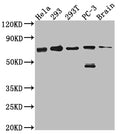 Western Blot
Positive WB detected in: Hela whole cell lysate, 293 whole cell lysate, 293T whole cell lysate, PC-3 whole cell lysate, Mouse Brain whole cell lysate
All lanes: LTA4H antibody at 1:1000
Secondary
Goat polyclonal to rabbit IgG at 1/50000 dilution
Predicted band size: 70, 60, 58, 67 kDa
Observed band size: 70 kDa