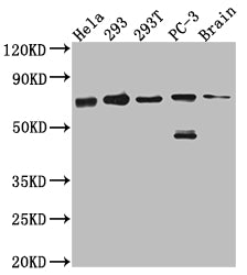 Western Blot
Positive WB detected in: Hela whole cell lysate, 293 whole cell lysate, 293T whole cell lysate, PC-3 whole cell lysate, Mouse Brain whole cell lysate
All lanes: LTA4H antibody at 1:1000
Secondary
Goat polyclonal to rabbit IgG at 1/50000 dilution
Predicted band size: 70, 60, 58, 67 kDa
Observed band size: 70 kDa