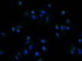 Immunofluorescence staining of A549 cell with CSB-RA199041A0HU at 1:50 , counter-stained with DAPI. The cells were fixed in 4% formaldehyde, permeabilized using 0.2% Triton X-100 and blocked in 10% normal Goat Serum. The cells were then incubated with the antibody overnight at 4°C. The secondary antibody was Alexa Fluor 488-congugated AffiniPure Goat Anti-Rabbit IgG(H+L).