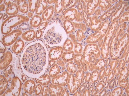 IHC image of CSB-RA199069A0HU diluted at 1:100 and staining in paraffin-embedded human kidney tissue performed on a Leica BondTM system. After dewaxing and hydration, antigen retrieval was mediated by high pressure in a citrate buffer (pH 6.0). Section was blocked with 10% normal goat serum 30min at RT. Then primary antibody (1% BSA) was incubated at 4°C overnight. The primary is detected by a Goat anti-rabbit polymer IgG labeled by HRP and visualized using 0.05% DAB.