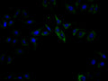 Immunofluorescence staining of Hela cell with CSB-RA199787A0HU at 1:50, counter-stained with DAPI. The cells were fixed in 4% formaldehyde, permeabilized using 0.2% Triton X-100 and blocked in 10% normal Goat Serum. The cells were then incubated with the antibody overnight at 4°C. The secondary antibody was Alexa Fluor 488-congugated AffiniPure Goat Anti-Rabbit IgG(H+L) .