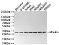 Western Blot
Positive WB detected in: SH-SY5Y whole cell lysate(30µg) , U-251MG whole cell lysate(30µg) , Jurkat whole cell lysate(30µg) , K562 whole cell lysate(30µg) , HEK293 whole cell lysate(30µg) , HEK293T whole cell lysate(30µg) , SW620 whole cell lysate(30µg) 
All lanes: Parkin antibody at 1:1000
Secondary
Goat polyclonal to rabbit IgG at 1/50000 dilution
Predicted band size: 52 kDa
Observed band size: 30 kDa
Exposure time: 2min