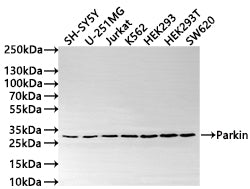Western Blot
Positive WB detected in: SH-SY5Y whole cell lysate(30µg) , U-251MG whole cell lysate(30µg) , Jurkat whole cell lysate(30µg) , K562 whole cell lysate(30µg) , HEK293 whole cell lysate(30µg) , HEK293T whole cell lysate(30µg) , SW620 whole cell lysate(30µg) 
All lanes: Parkin antibody at 1:1000
Secondary
Goat polyclonal to rabbit IgG at 1/50000 dilution
Predicted band size: 52 kDa
Observed band size: 30 kDa
Exposure time: 2min