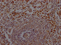 IHC image of CSB-RA200985A0HU diluted at 1:100 and staining in paraffin-embedded human spleen tissue performed on a Leica BondTM system. After dewaxing and hydration, antigen retrieval was mediated by high pressure in a citrate buffer (pH 6.0) . Section was blocked with 10% normal goat serum 30min at RT. Then primary antibody (1% BSA) was incubated at 4℃ overnight. The primary is detected by a Goat anti-rabbit IgG polymer labeled by HRP and visualized using 0.05% DAB.