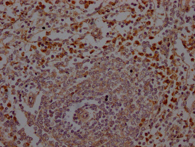 IHC image of CSB-RA200985A0HU diluted at 1:100 and staining in paraffin-embedded human spleen tissue performed on a Leica BondTM system. After dewaxing and hydration, antigen retrieval was mediated by high pressure in a citrate buffer (pH 6.0) . Section was blocked with 10% normal goat serum 30min at RT. Then primary antibody (1% BSA) was incubated at 4℃ overnight. The primary is detected by a Goat anti-rabbit IgG polymer labeled by HRP and visualized using 0.05% DAB.