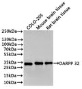 Western Blot
Positive WB detected in: COLO-205 whole cell lysate(30µg), Mouse brain tissue lysate(30µg), Rat brain tissue lysate(30µg)
All lanes: PAP antibody at 1:1000
Secondary
Goat polyclonal to rabbit IgG at 1/40000 dilution
Predicted band size: 23 kDa
Observed band size: 32 kDa
Exposure time：30s