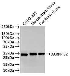 Western Blot
Positive WB detected in: COLO-205 whole cell lysate(30µg), Mouse brain tissue lysate(30µg), Rat brain tissue lysate(30µg)
All lanes: PAP antibody at 1:1000
Secondary
Goat polyclonal to rabbit IgG at 1/40000 dilution
Predicted band size: 23 kDa
Observed band size: 32 kDa
Exposure time：30s