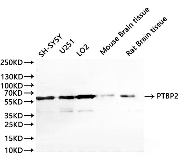 Western Blot, 
Positive WB detected in: SH-SY5Y whole cell lysate(30µg), U251 whole cell lysate(30µg), LO2 whole cell lysate(30µg), Mouse brain tissue lysate(30µg), Rat brain tissue lysate(30µg)
All lanes: PTBP2 antibody at 1:1000
Secondary
Goat polyclonal to rabbit IgG at 1/40000 dilution
Predicted band size: 57 kDa
Observed band size: 57 kDa
Exposure time：60s