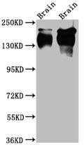 Western Blot
Positive WB detected in: Rat Brain whole cell lysate, Mouse Brain whole cell lysate
All lanes: TrkA Antibody at 1:1000
Secondary
Goat polyclonal to rabbit IgG at 1/50000 dilution
Predicted band size: 88, 87, 84, 78 kDa
Observed band size: 145 kDa