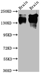 Western Blot
Positive WB detected in: Rat Brain whole cell lysate, Mouse Brain whole cell lysate
All lanes: TrkA Antibody at 1:1000
Secondary
Goat polyclonal to rabbit IgG at 1/50000 dilution
Predicted band size: 88, 87, 84, 78 kDa
Observed band size: 145 kDa