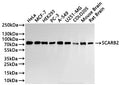 Western Blot
Positive WB detected in: Hela whole cell lysate(30µg), MCF7 whole cell lysate(30µg), HEK293 whole cell lysate(30µg), PC-3 whole cell lysate(30µg), A549 whole cell lysate(30µg), U251 whole cell lysate(30µg), COLO205 whole cell lysate(30µg), Mouse brain tissue lysate(30µg), Rat brain tissue lysate(30µg)
All lanes:SCARB2 antibody at 1:1000
Secondary
Goat polyclonal to rabbit IgG at 1/40000 dilution
Predicted band size: 54 kDa
Observed band size: 77 kDa
Exposure time：1min
