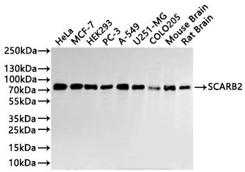 Western Blot
Positive WB detected in: Hela whole cell lysate(30µg), MCF7 whole cell lysate(30µg), HEK293 whole cell lysate(30µg), PC-3 whole cell lysate(30µg), A549 whole cell lysate(30µg), U251 whole cell lysate(30µg), COLO205 whole cell lysate(30µg), Mouse brain tissue lysate(30µg), Rat brain tissue lysate(30µg)
All lanes:SCARB2 antibody at 1:1000
Secondary
Goat polyclonal to rabbit IgG at 1/40000 dilution
Predicted band size: 54 kDa
Observed band size: 77 kDa
Exposure time：1min